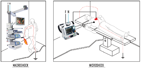 macroshock-e-microshock